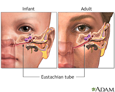 What Does An Ear Infection Feel Like