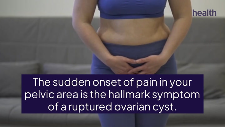 What To Expect After An Ovarian Cyst Ruptures