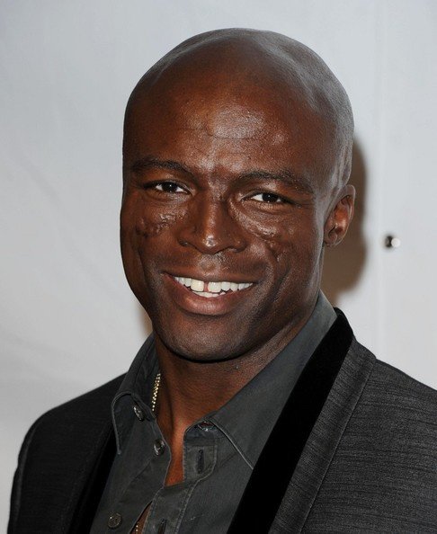 What Happened To Seal'S Face