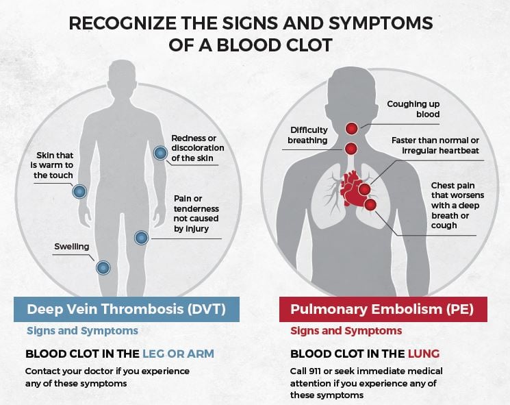 What Does A Blood Clot Feel Like